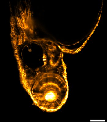 A 2dpf zebrafish larvae is imaged using a LSFM setup developed at ICFO, at the Super-resolution Light microscopy and Nanoscopy (SLN) facility with a double illumination scheme. (Scale bar 100 um)
