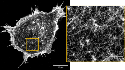 Super-resolution image of the actin cortex of fixed HEK cells on a glass coverslip