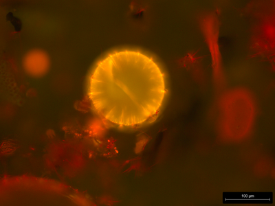 Fluorescence microscopy of microplastic particles from the river Rhine, stained with Nie Red dye. The yellow sphere was identified as polystyrene, based on its Raman spectrum. (Merel Konings & Freek Ariese) 